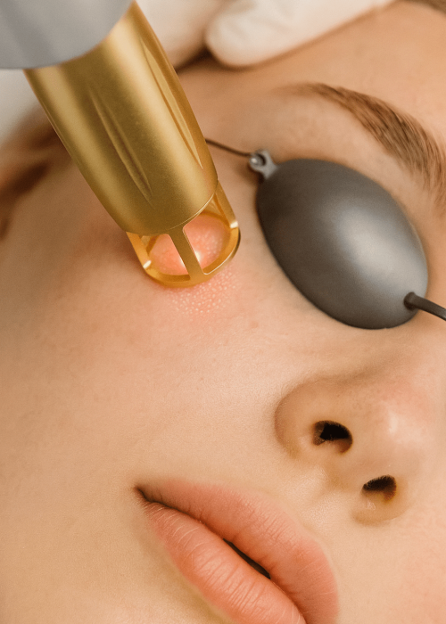 20250916_1319_Tratamento a Laser Facial_remix_01k59n2apvfmbbr66t9rpaw34f