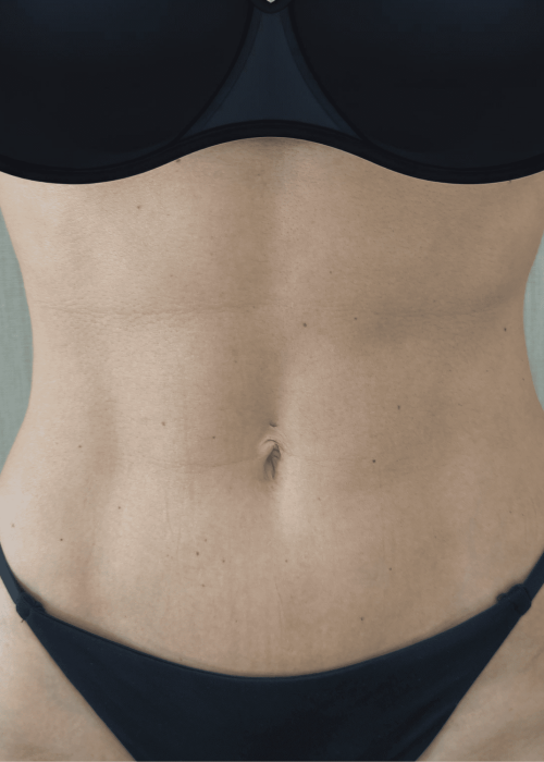 bioestimulador barriga